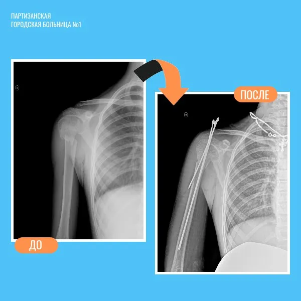 Детская травма